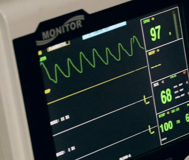 Monitor koji prikazuje rad srca